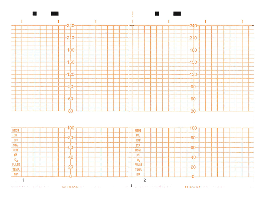 Foetal monitors, cardiotocographs, Z-FOLD PAPER 151x100 mm for 29551 - 150 sheet