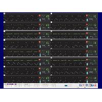 Pacientu monitorings