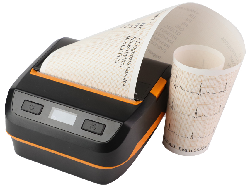 EKG un 24 stundu EKG, Bluetooth termiskais printeris ar 3 kanāliem, paredzēts 54230