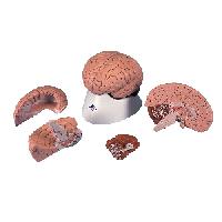 Brain Model, 4 part